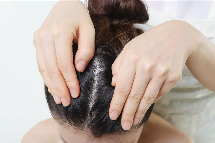 People Are Getting Scalp Botox, and You Won't Believe Why